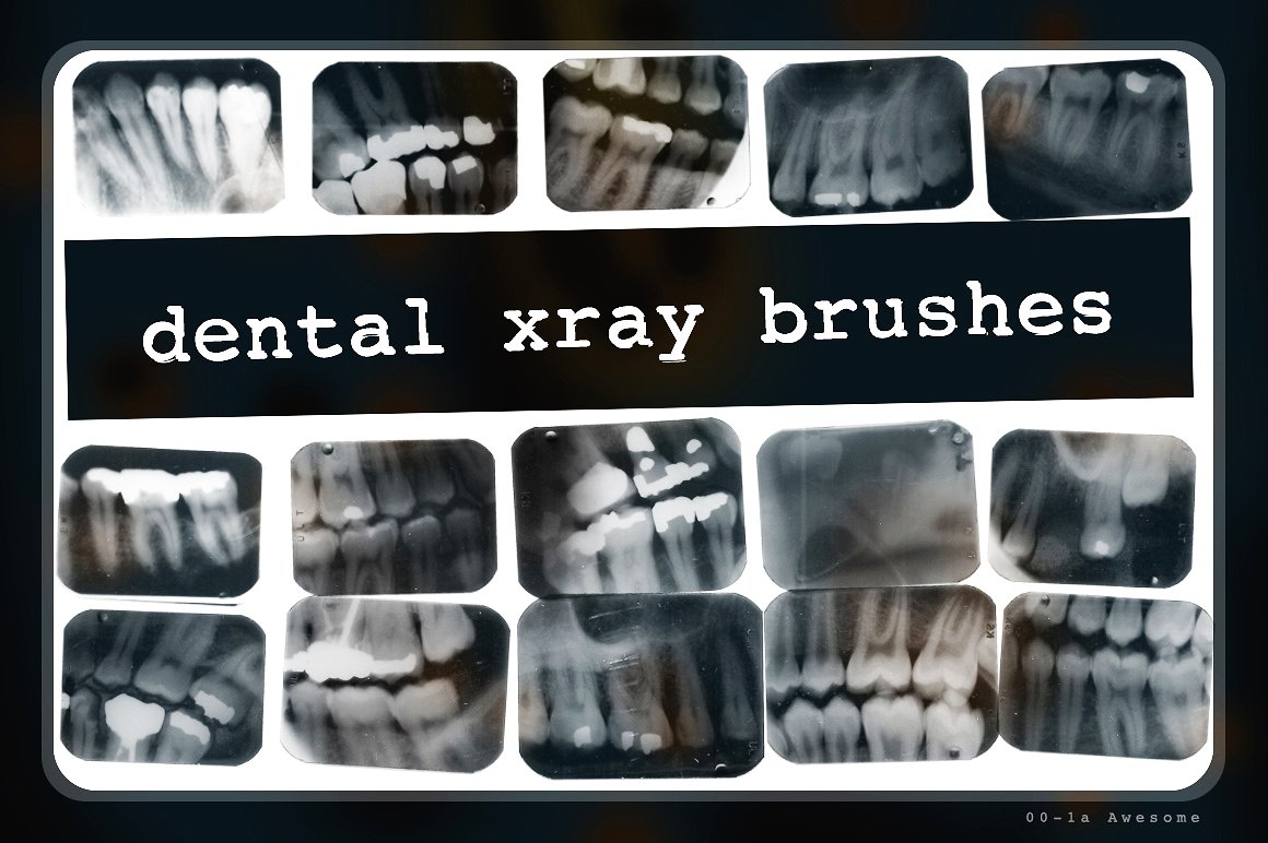 50张高清矢量牙齿X射透明线笔刷Dental X-ray B