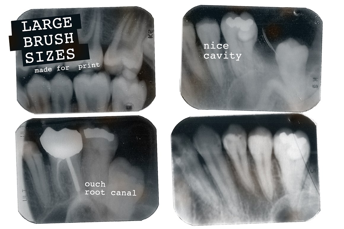 50张高清矢量牙齿X射透明线笔刷Dental X-ray B