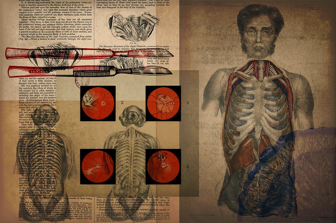 复古医疗医学插图素材 Medical-Art-110-EPS