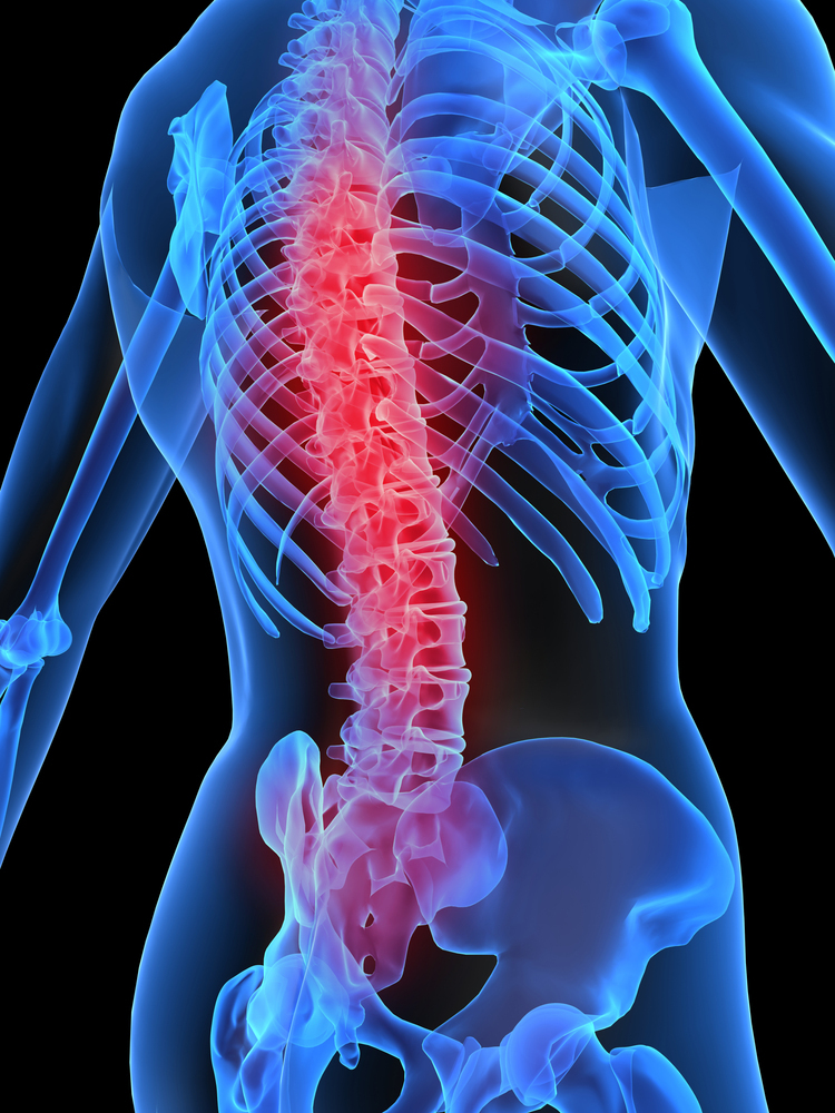 脊椎腰间盘突出脊髓人体解剖医疗科技图片