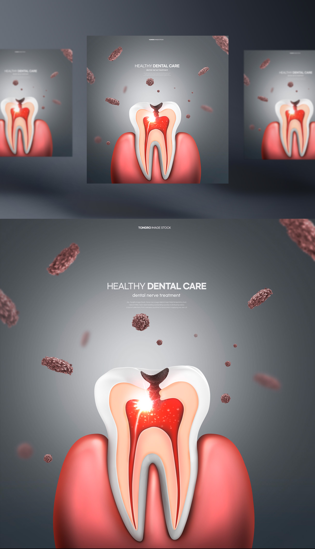 牙齿清洁修护保护牙医院卫生治疗宣传PSD海报模板 Healt